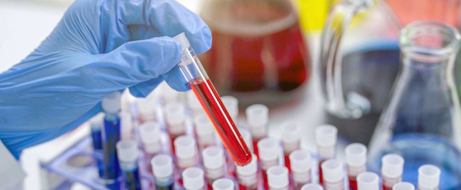 hands of a lab technician with a tube of blood sample and a rack with other samples.