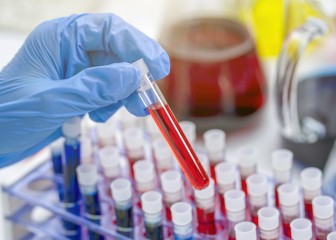 hands of a lab technician with a tube of blood sample and a rack with other samples.
