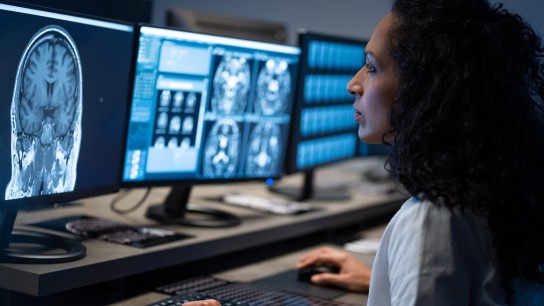 Side view of female radiologist looking at the MRI image of the head on her monitor and analysing it.