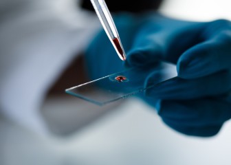 Close up shot of unrecognizable scientist, in surgical gloves, putting a drop of blood or red liquid, with a pipette, on a microscope slide, for analysis.