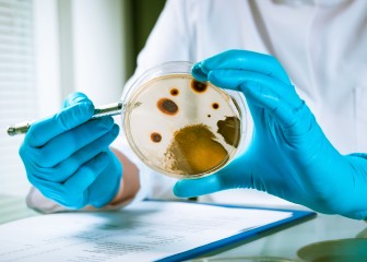 Agar plate with growing germs