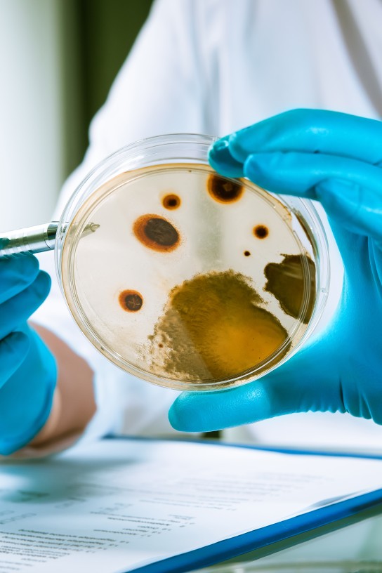 Agar plate with growing germs